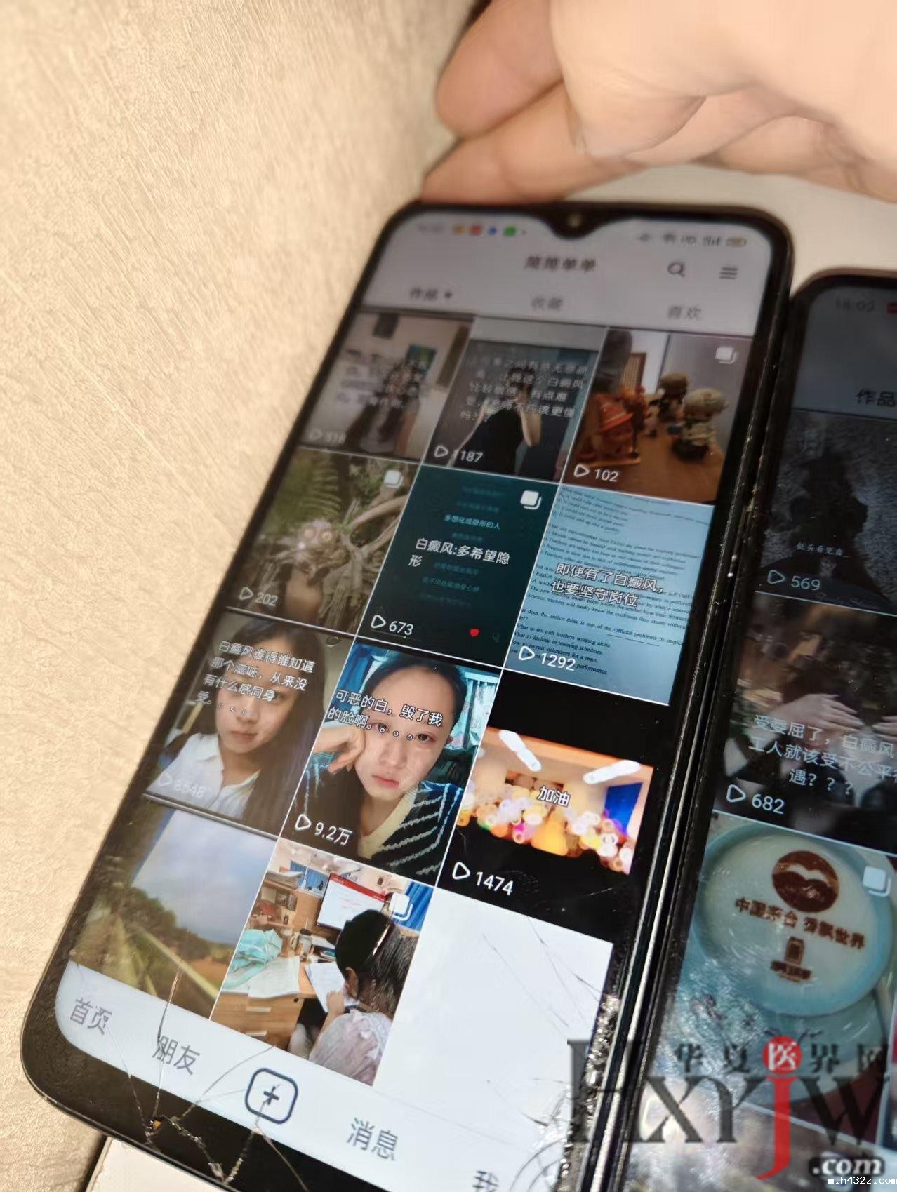 1762408818446438.jpg 1762408818446438.jpg